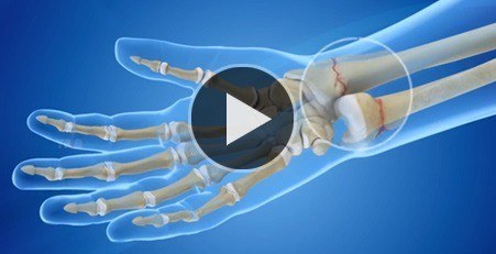 Multimedia - Rebecca S. Yu, MD - Hand and Upper Extremity Surgeon